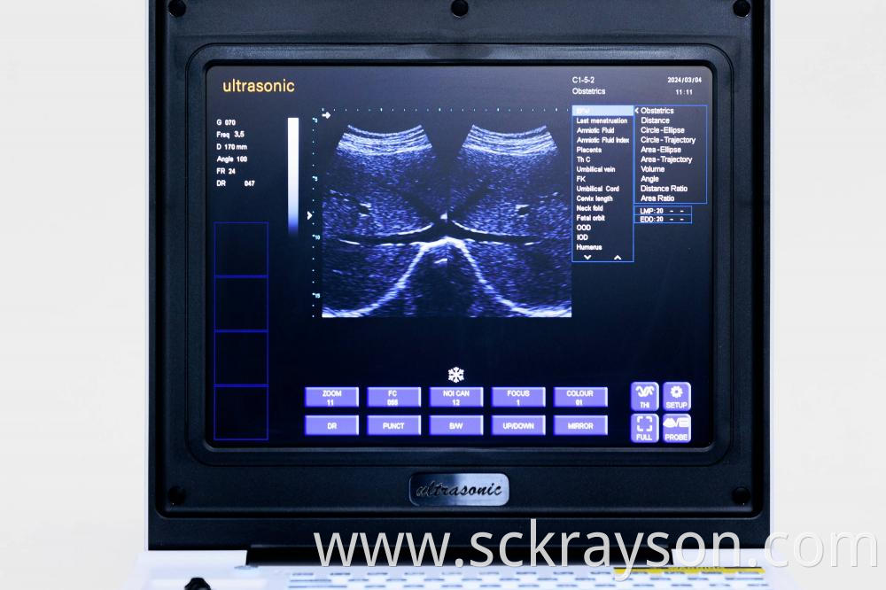Laptop Ultrasound Screen 2